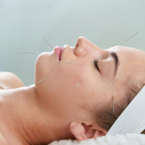 akupunktura kosmetologiczna pinezkowanie twarzy cieszyn