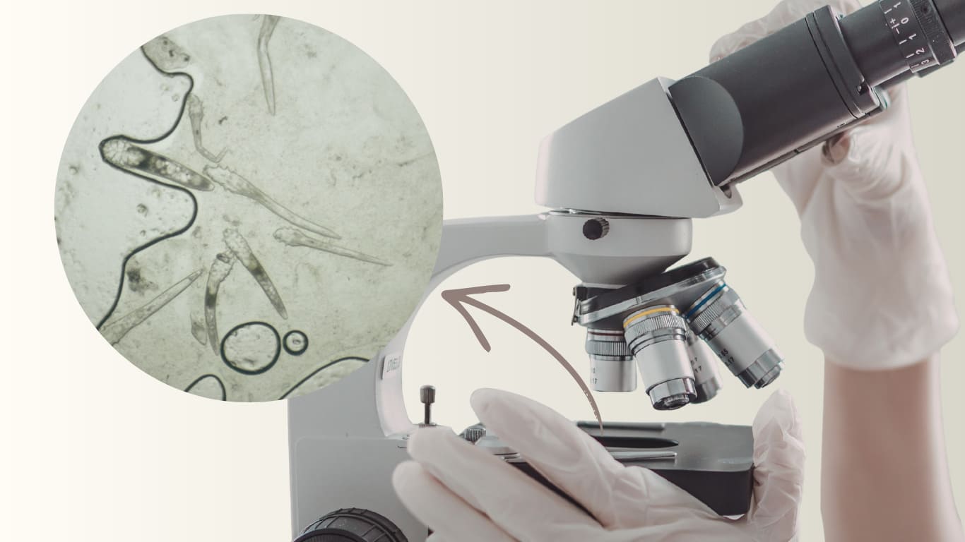 diagnostyka nużeńca demodex nużeniec na twarzy badanie laboratoryjne zabiegi na twarz cieszyn