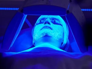 kleresca trądzik pospolity trądzik różowaty trądzik dorosłych cieszyn fotobiomodulacja