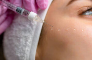 mezoterapia igłowa okolic oczu oka cieszyn