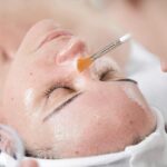 zabiegi kwasowe peelingi chemiczne cieszyn